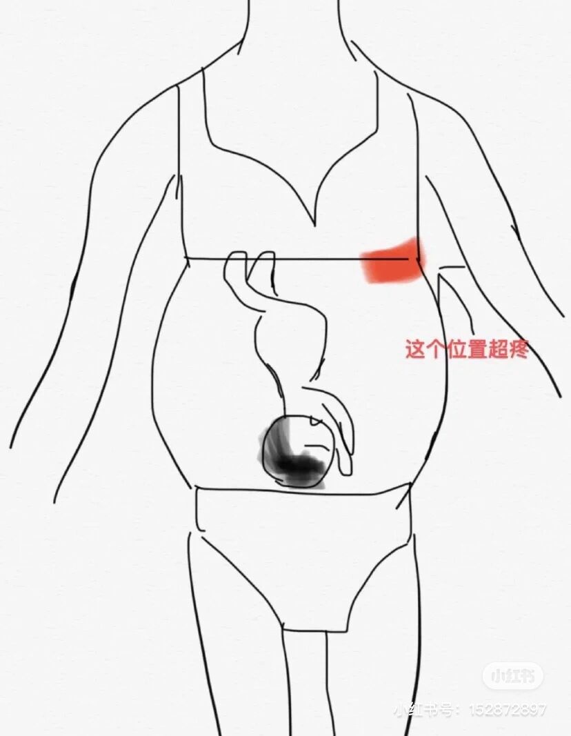 以我的经历来看是因为吃多了 所以我的建议是不要