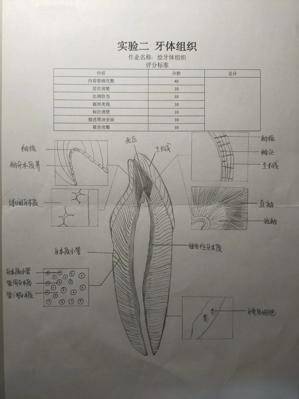 牙本质小管暴露图片