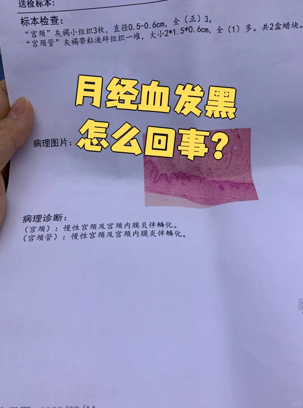 为什么月经过了还有血