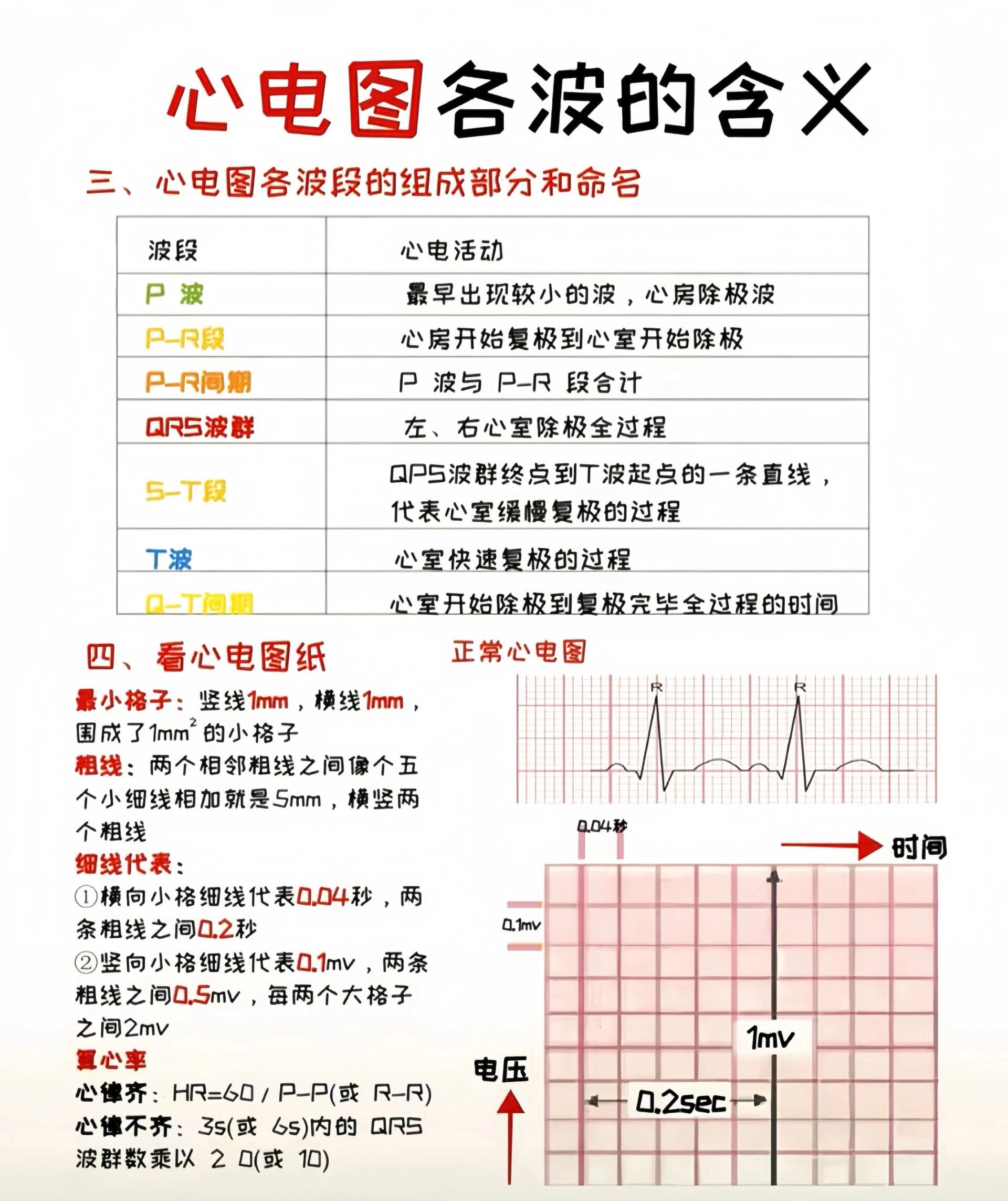 心电图各波的含义