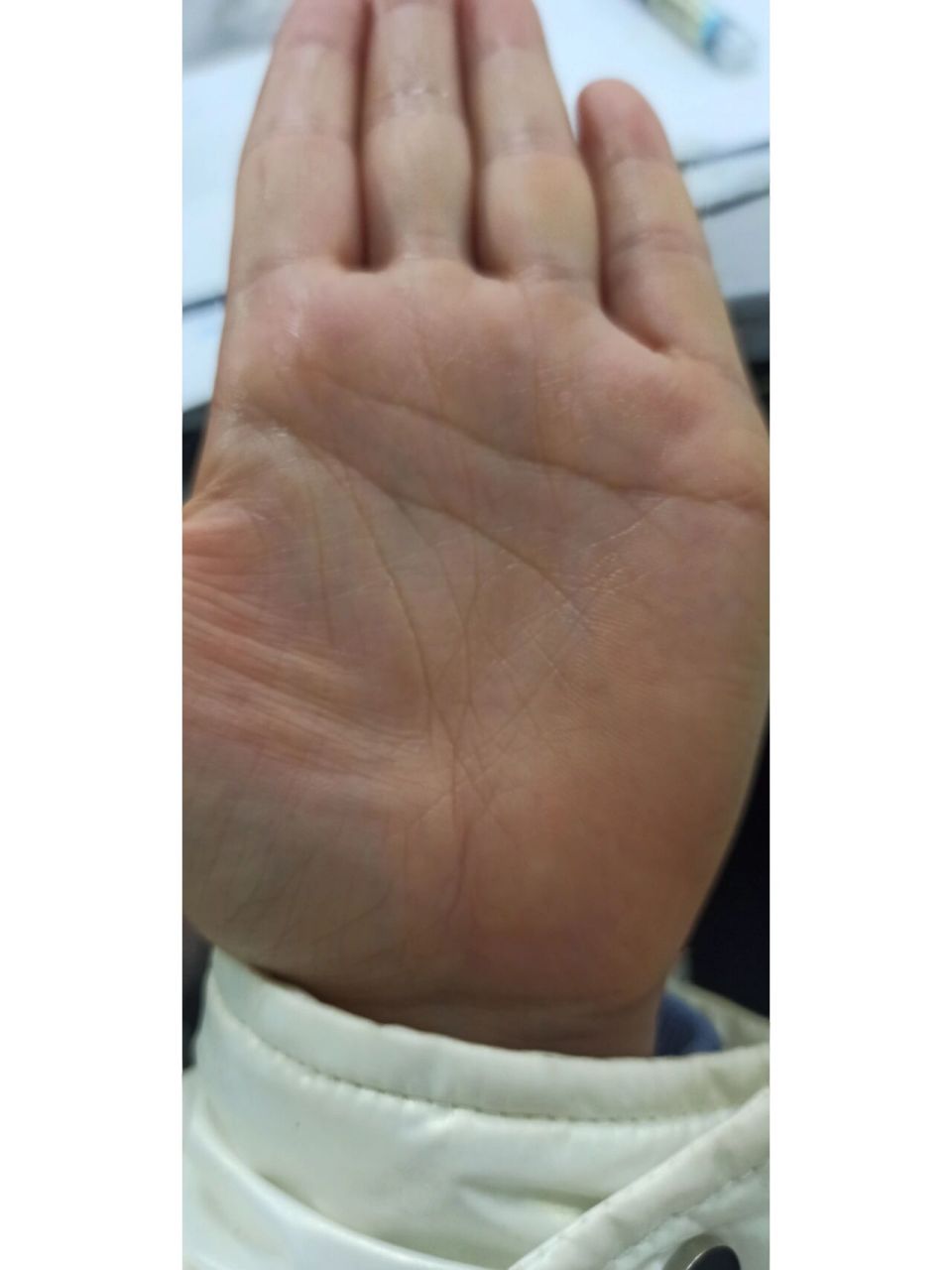 手相 双手生命线都短 分叉 短点 完蛋了 两只手生命线都短,一只手短