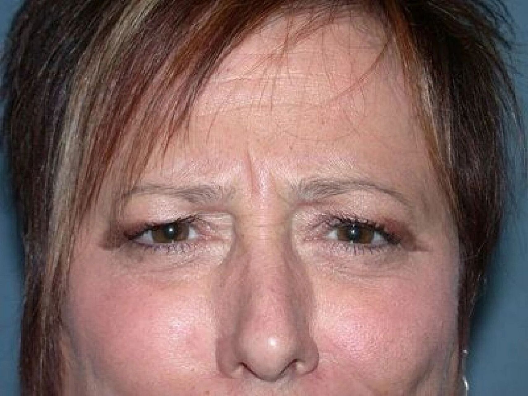 面相小课堂 印堂上左右眉边上各一条纹的,左主兄弟右主姐妹,不和协