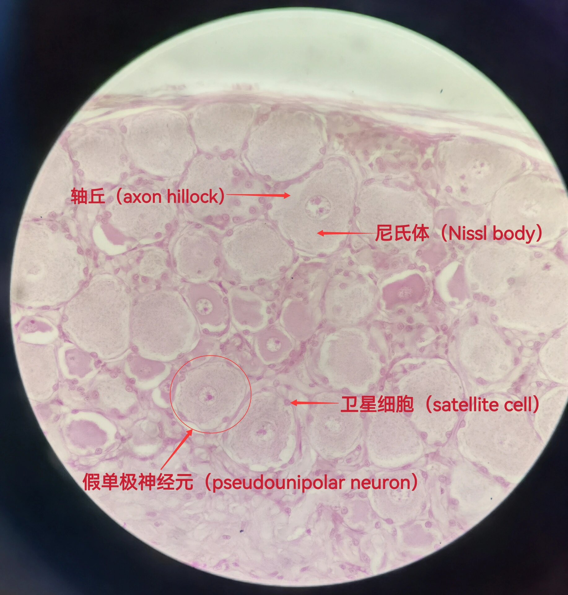 医学生必看!组胚红蓝手绘图—猫的脊神经节