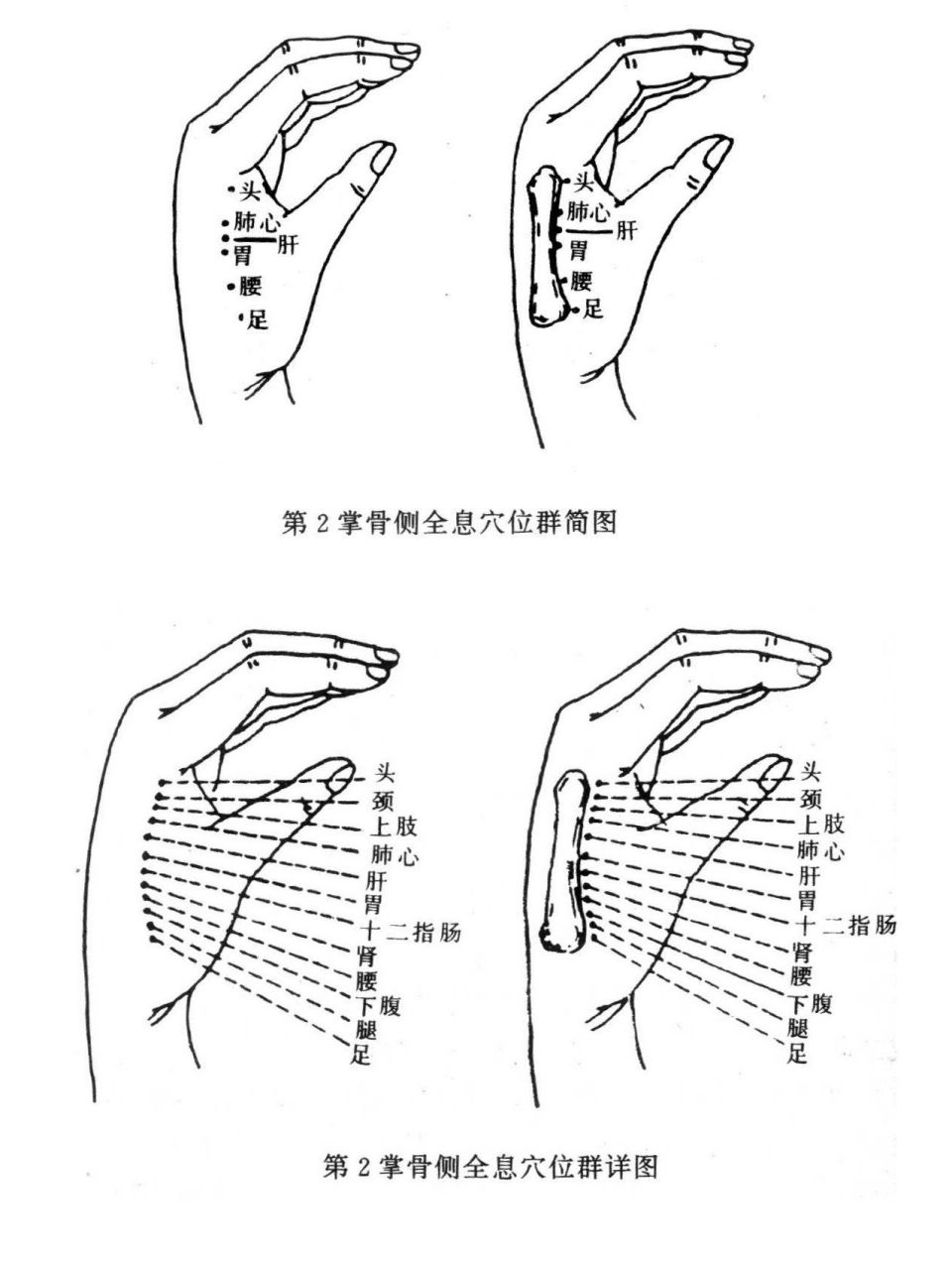 第二掌骨全息图疗法图片