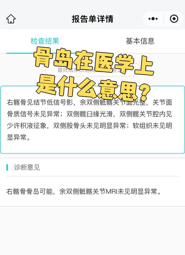 骨岛也叫内生骨疣,其实就是骨头里的一小块特别密的骨组织