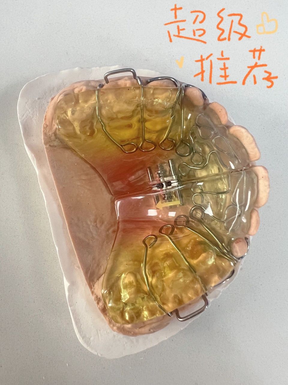 活动式扩弓器佩戴注意事项6015 一,必须保证足够的佩戴时间 螺旋