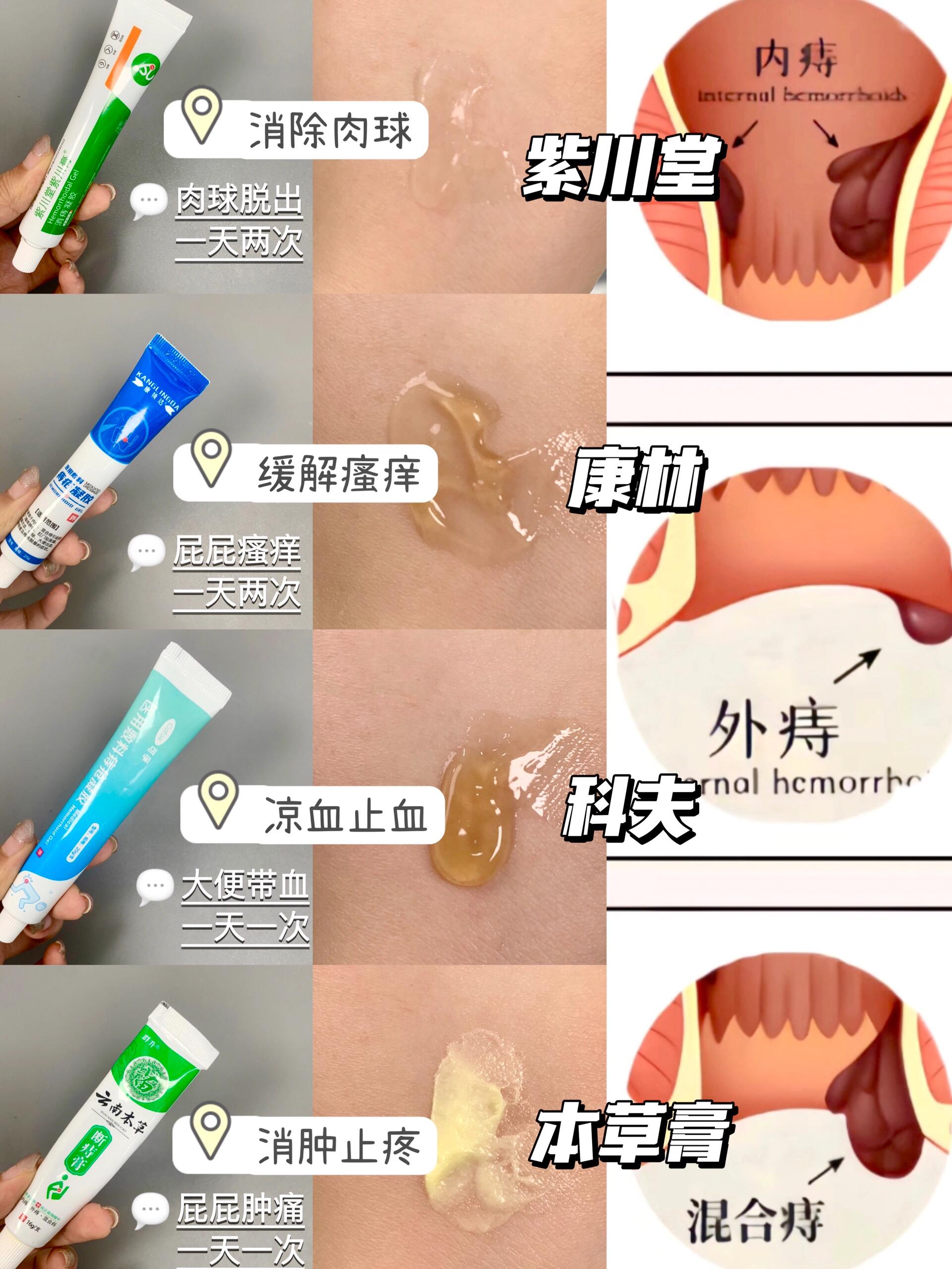 有话要说!好用的宝藏去痔痔疮药在这里!