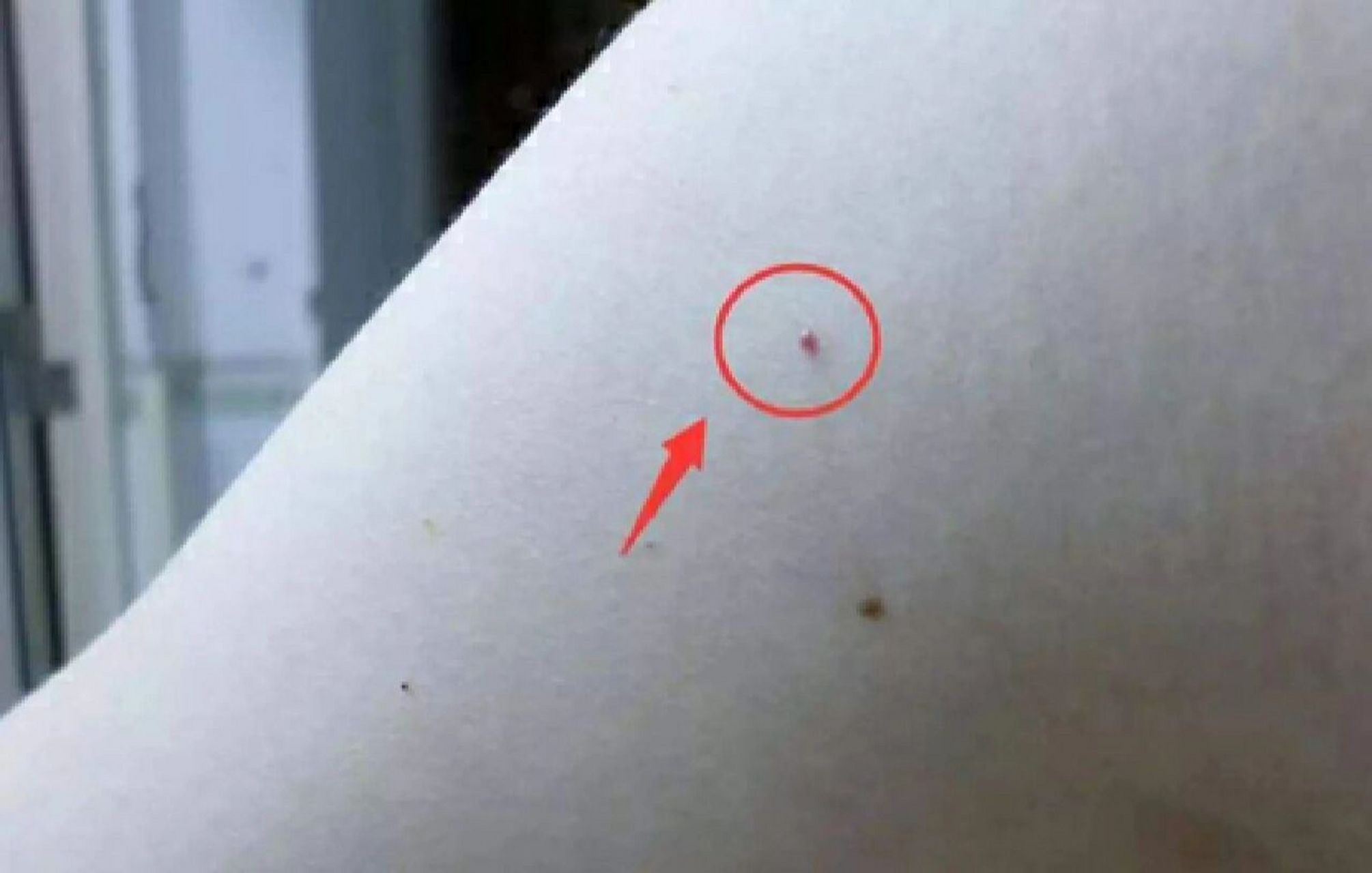 1 朱砂痣的出处 "朱砂痣",出于张爱玲小说《红玫瑰与白玫瑰》,"也许每