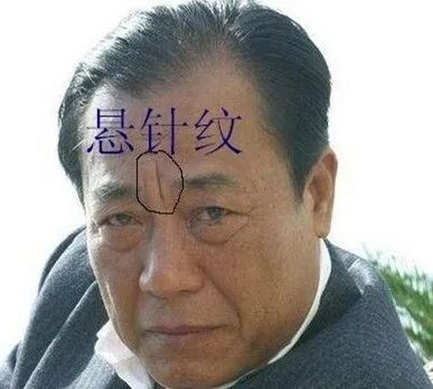 男人印堂川字纹大吉图片