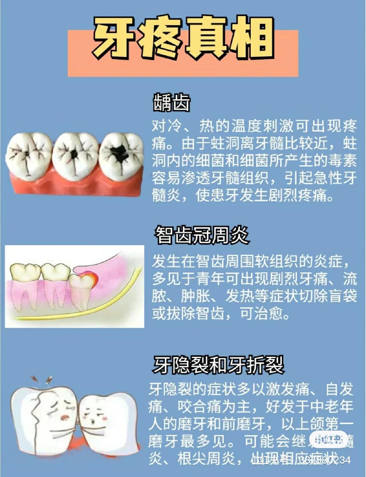 为什么牙痛不能拔牙?百科在线 为什么牙痛不能拔牙?百科在线