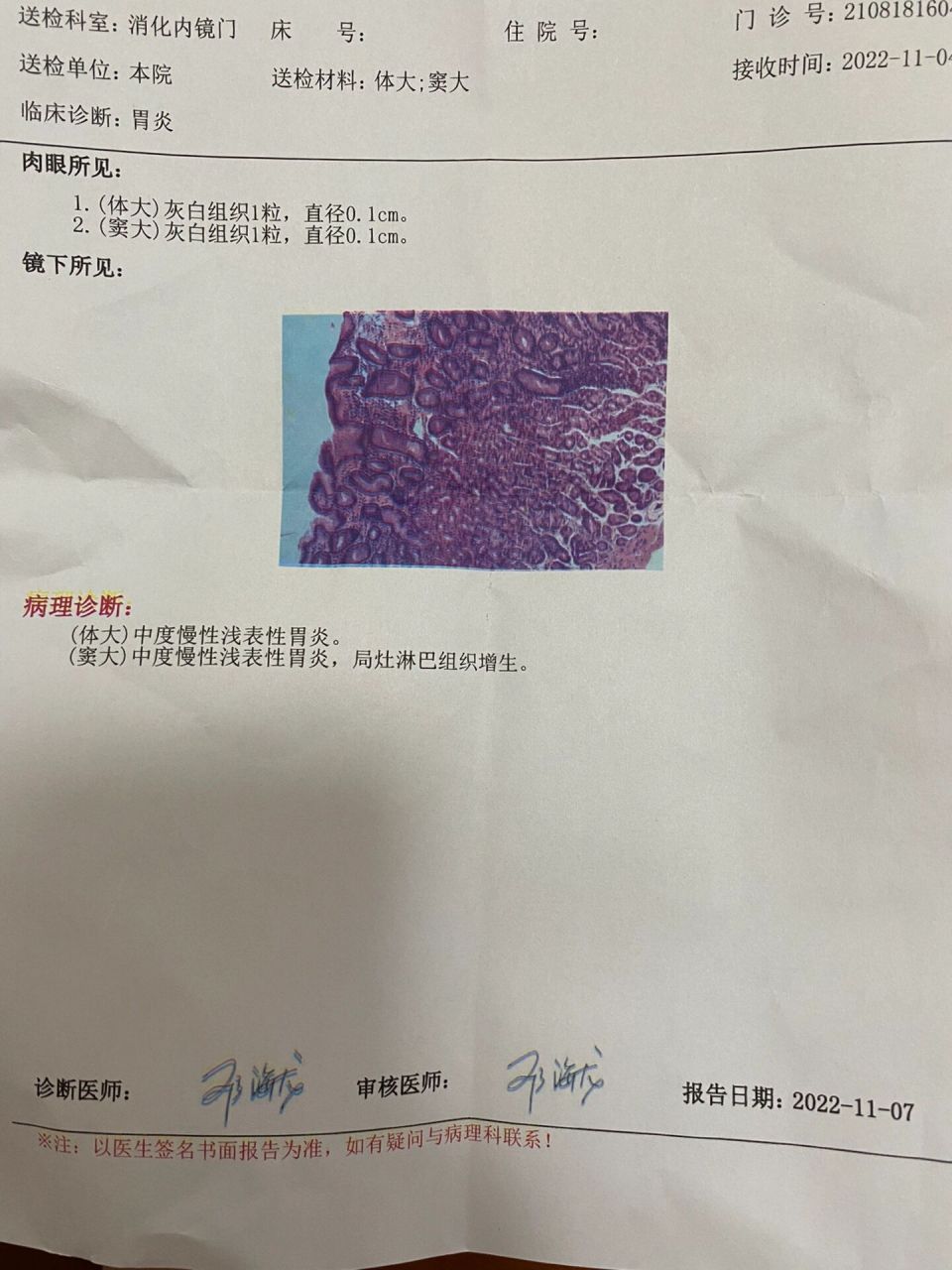 萎缩性胃炎伴中重度肠化逆转成功 对于这个病理结果,我是这么理解的