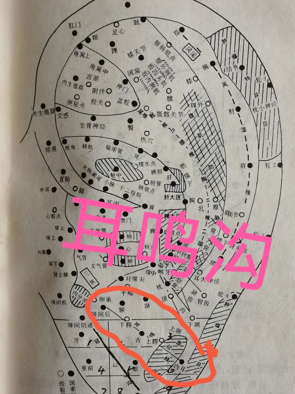 耳鸣沟耳部图片图片