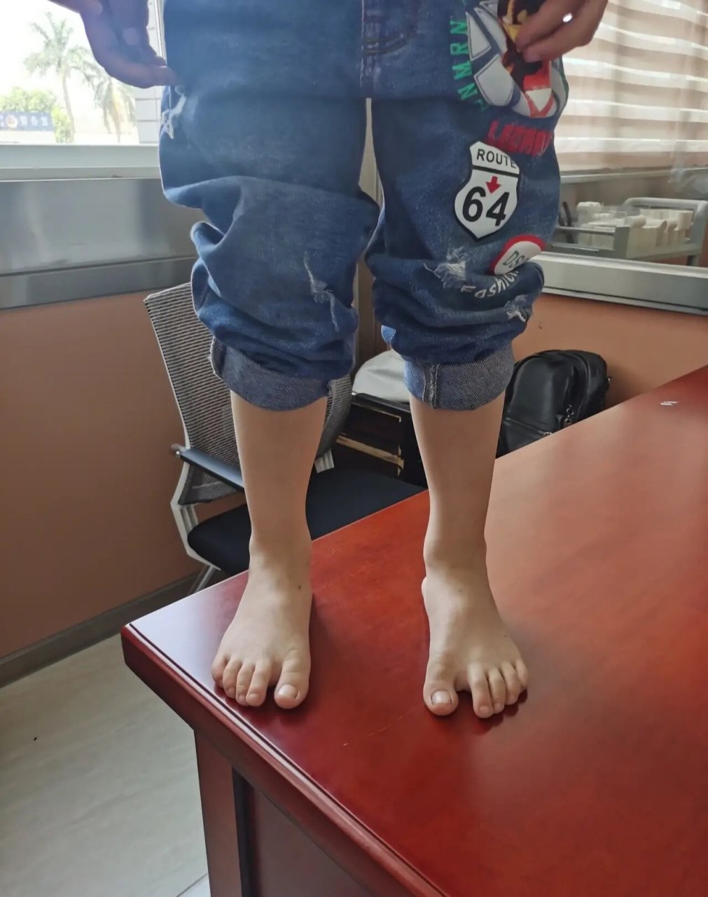 5岁的小男孩,3个月前因为走路总是说脚底酸痛,不肯走远路,跑不快