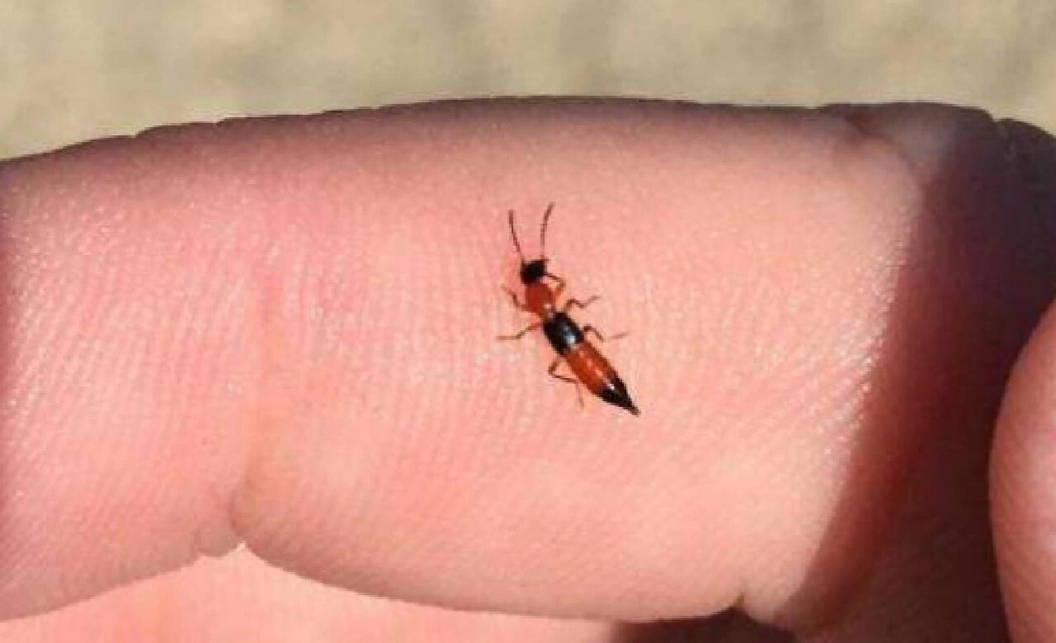 家里总是有隐翅虫怎么办 隐翅虫喜欢潮湿的环境,它们在家里出现一般