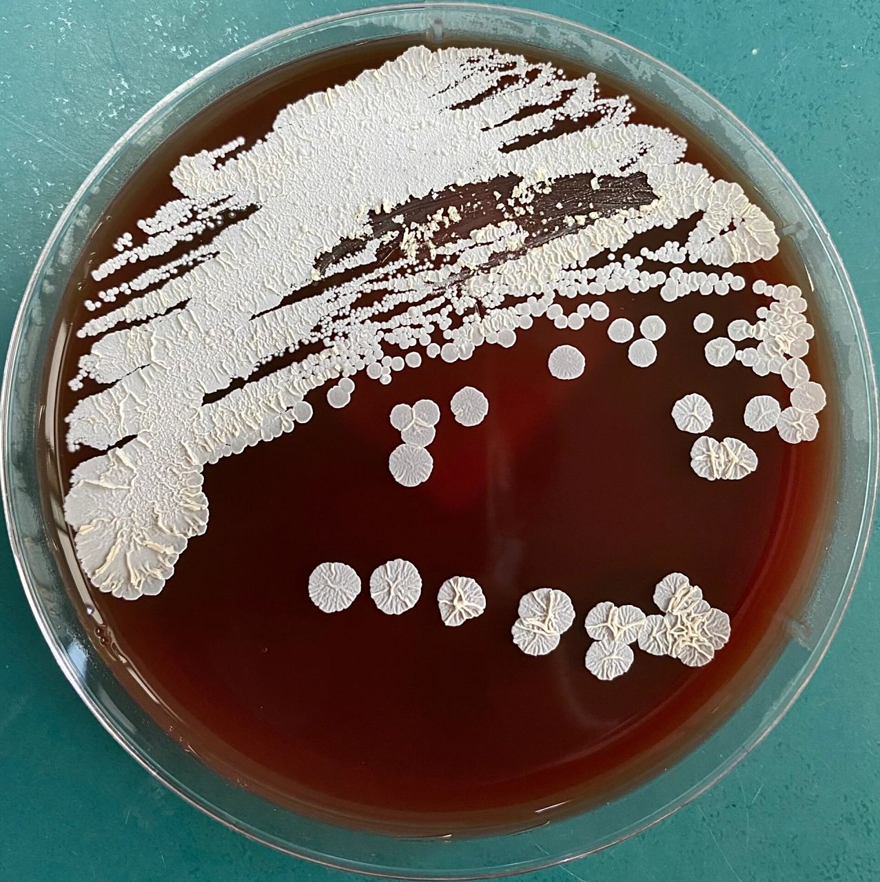 圣乔治教堂诺卡菌 balf培养,圣乔治教堂诺卡菌 p1,血平板菌落形态 p2