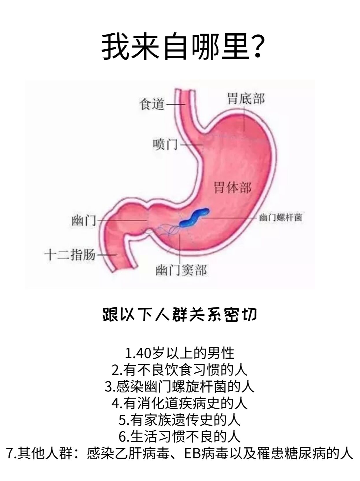 胃癌可发生于胃的任何部位