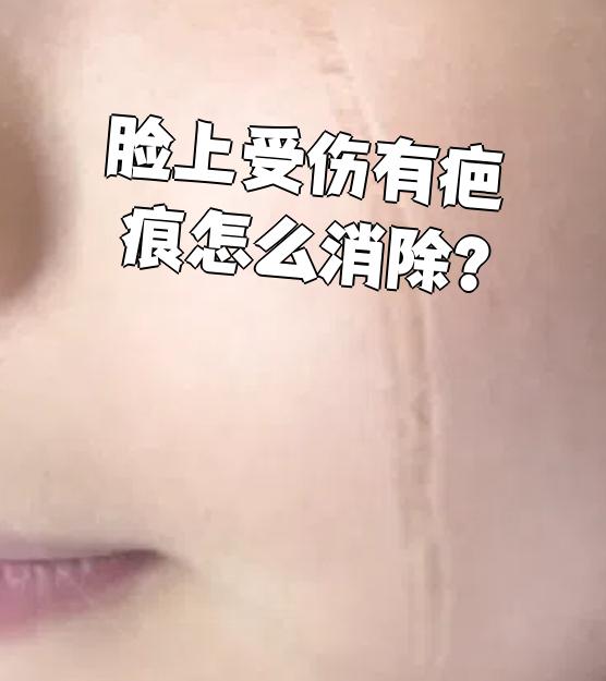 如果瘢痕出现红肿,疼痛等异常,要马上去医院检查