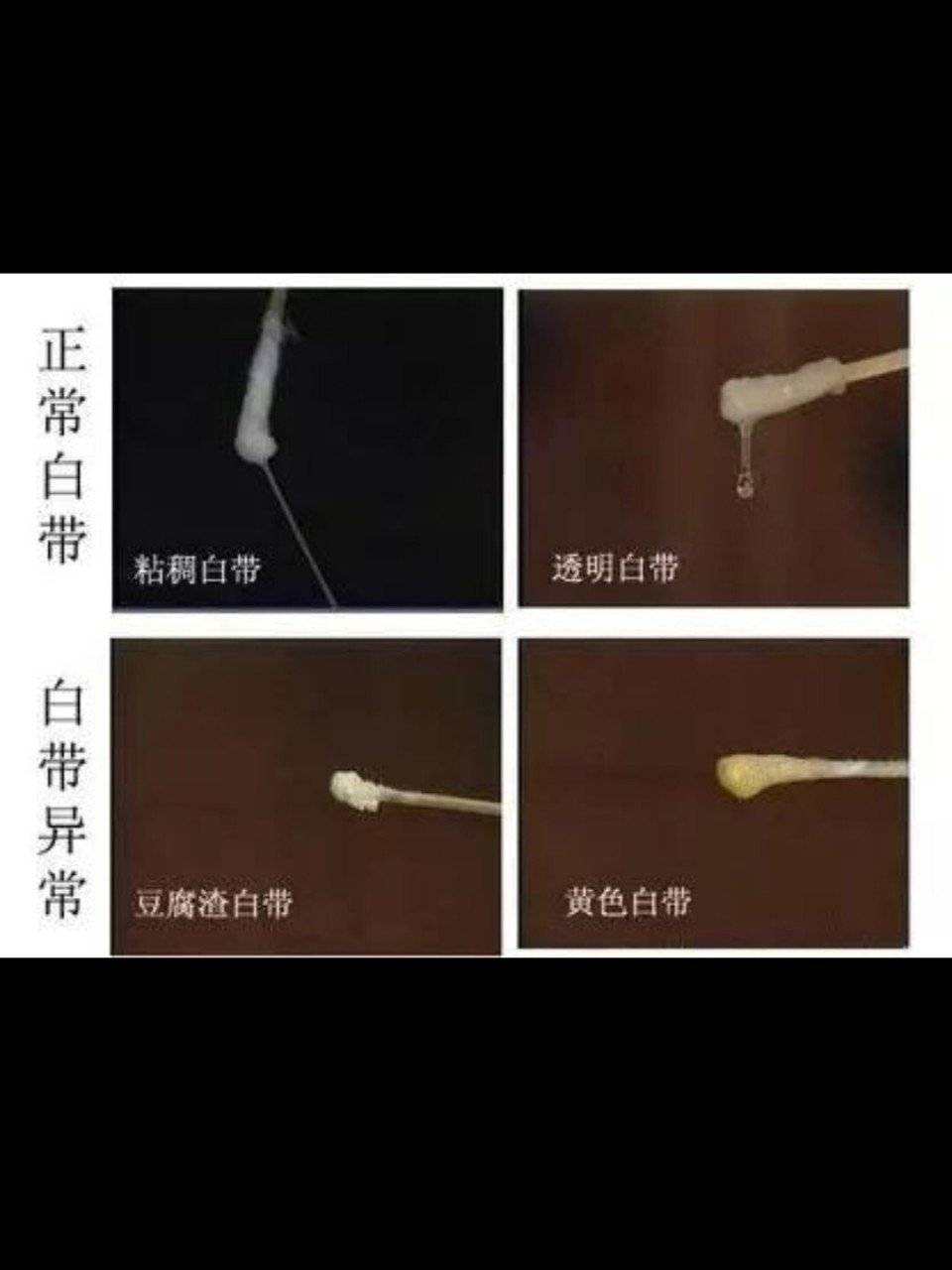 白带不正常怎么办图片