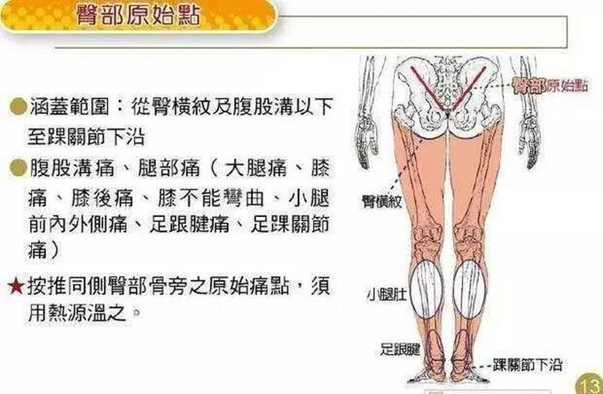 筋膜炎的位置示意图图片