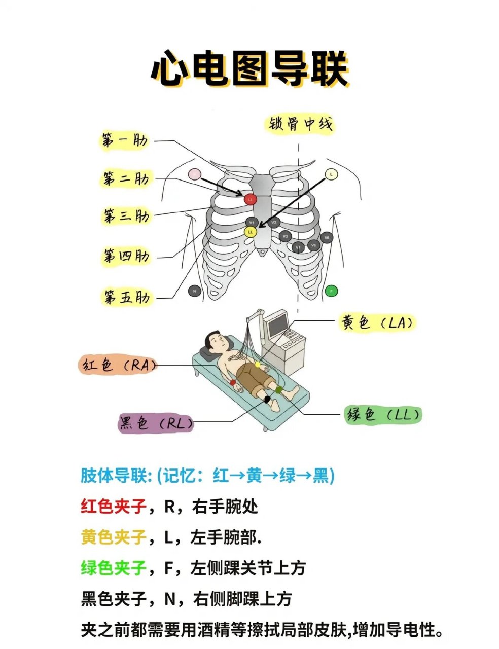 18导联心电图位置颜色图片