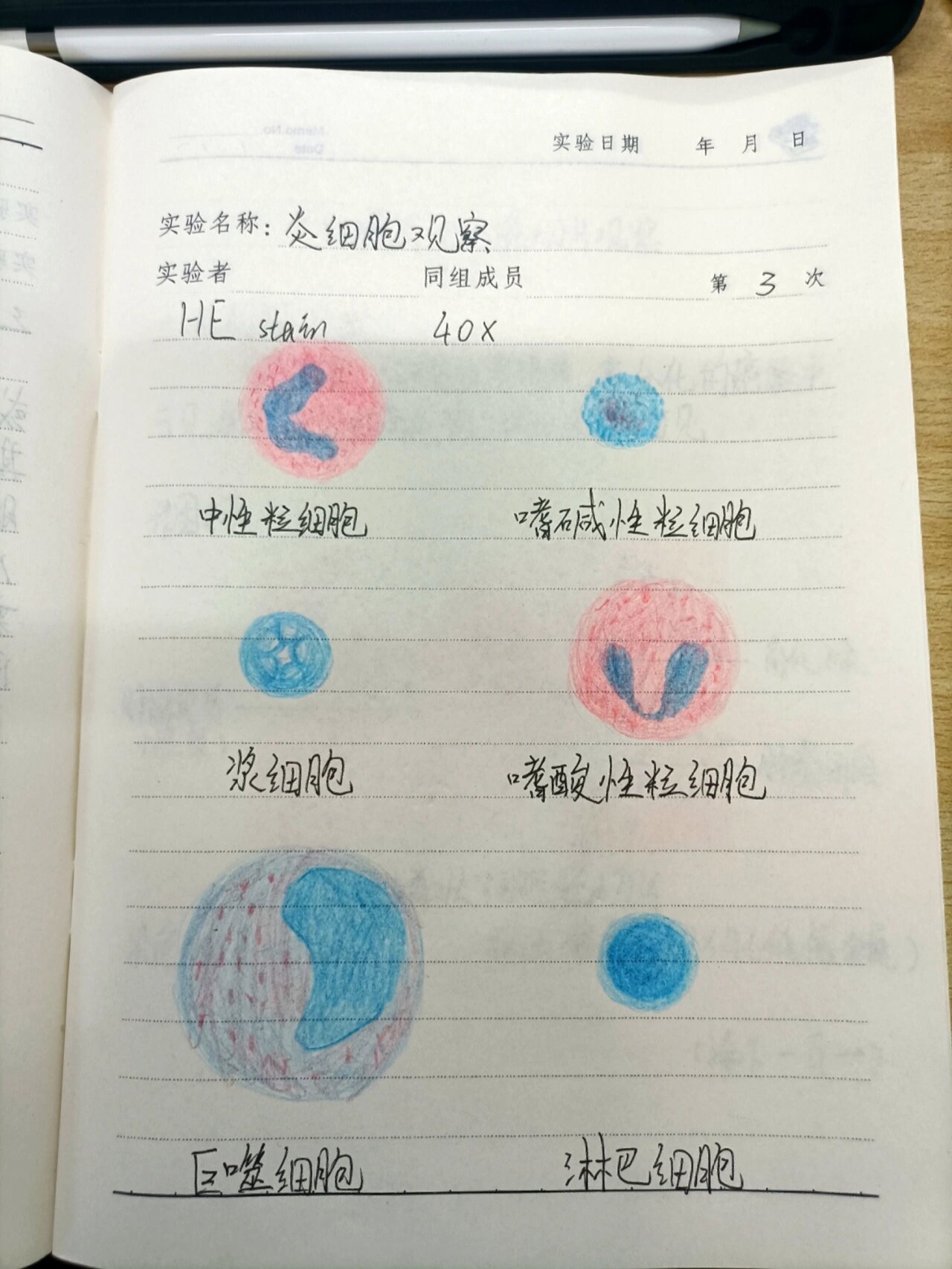 炎细胞 红蓝铅笔绘图