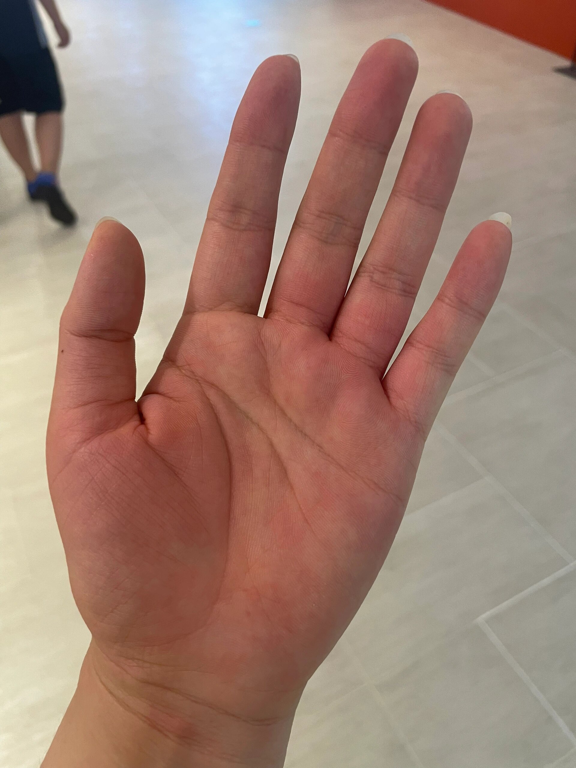 手掌无缘无故就会出现红肿痛,什么原因