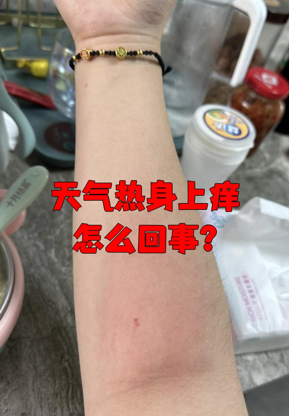 身体为什么一发热就会全身痒百科在线