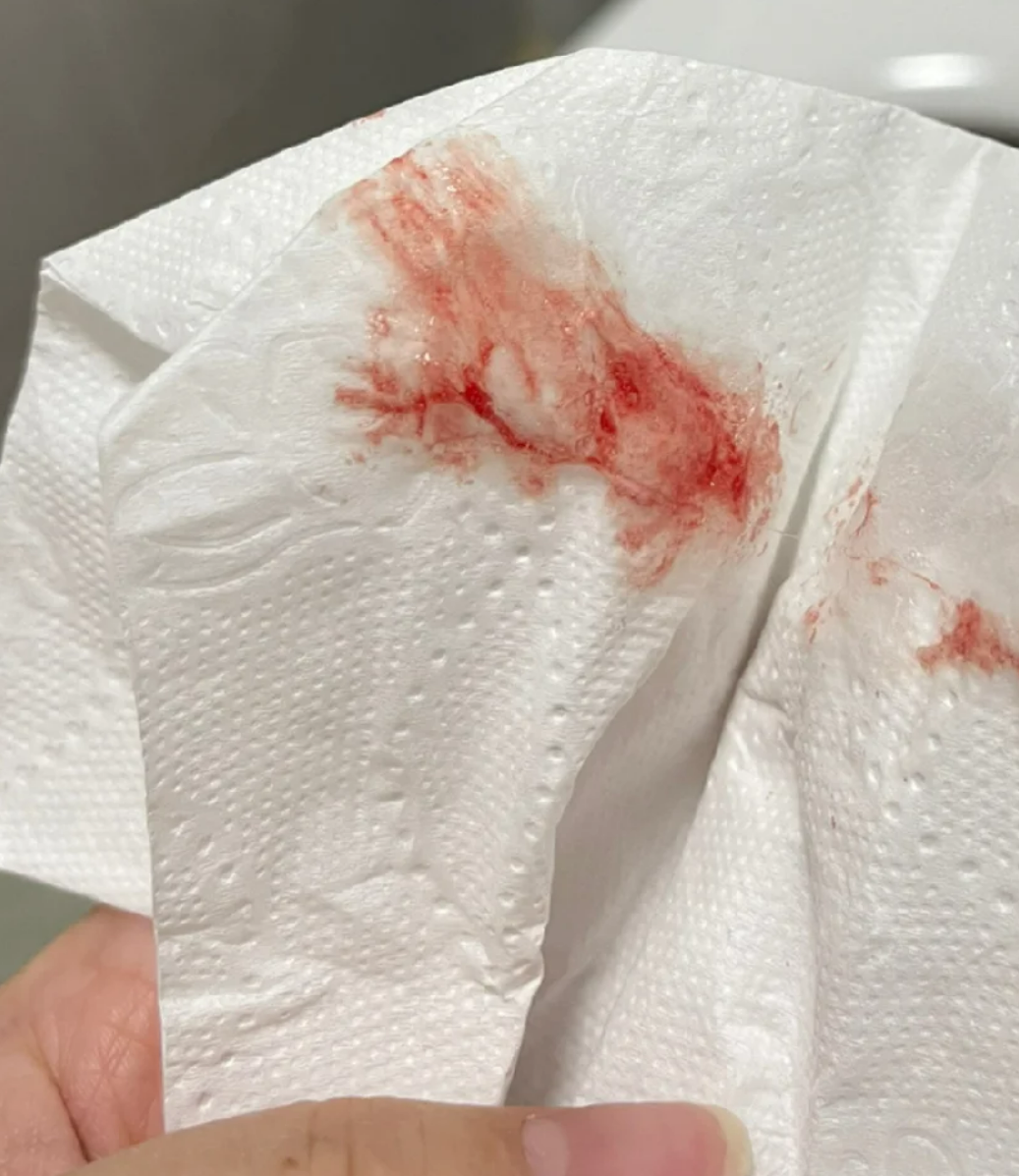 有些人会出现阴道不规则出血,也就是中