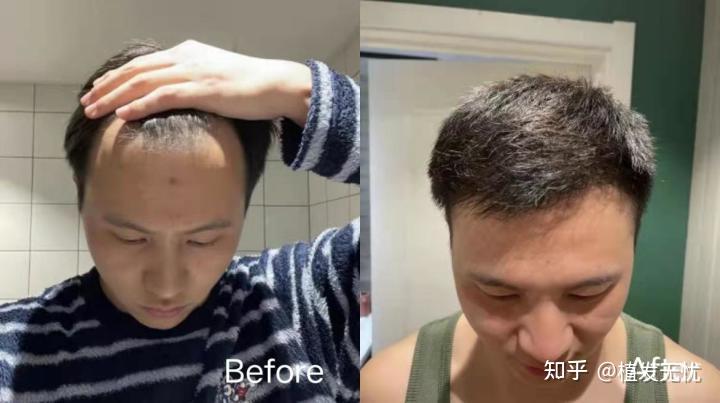 关于长春植发医院的信息
