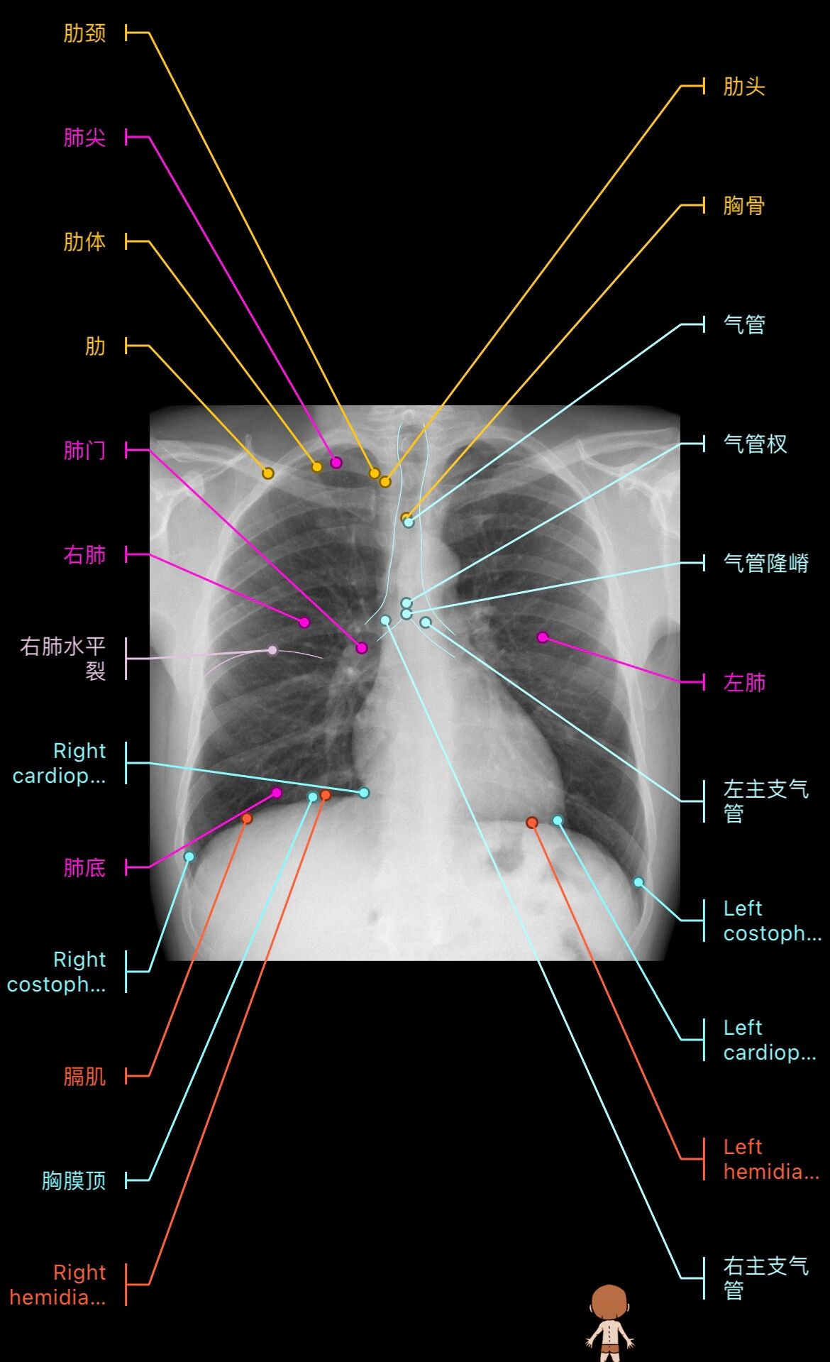 学习胸片🩻@锦绣前程的一生的动态