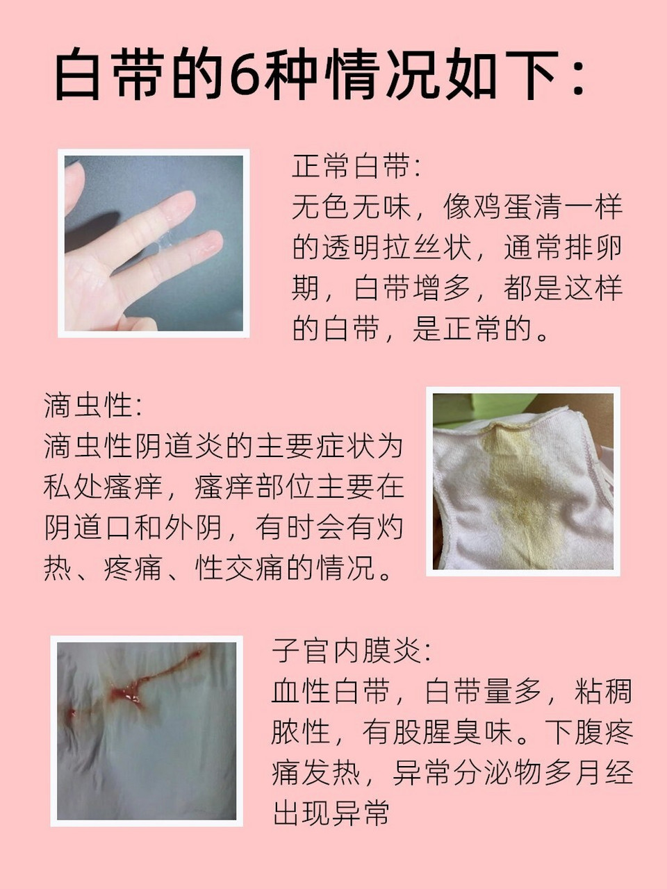 白带不正常很久了,用了它们终于解决了.
