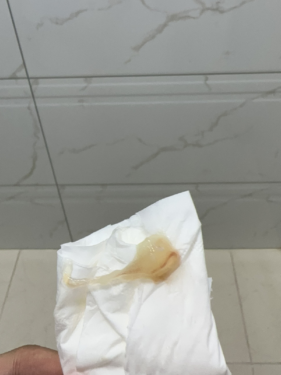 传说中的宫颈粘液栓,有图,介意勿往后翻 39 5了 二胎竟然比一胎有反应