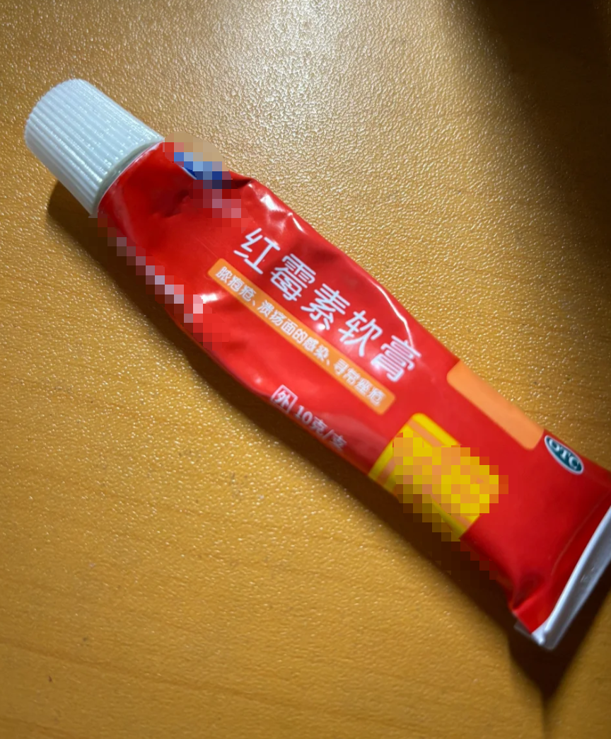 脚趾冻伤后发痒,可以试试这些方法: