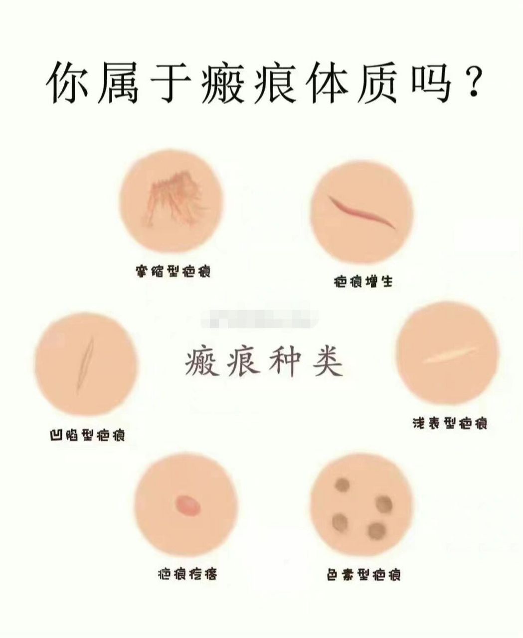 如何判断是不是疤痕体质? 如何判断你是否是疤痕体质?
