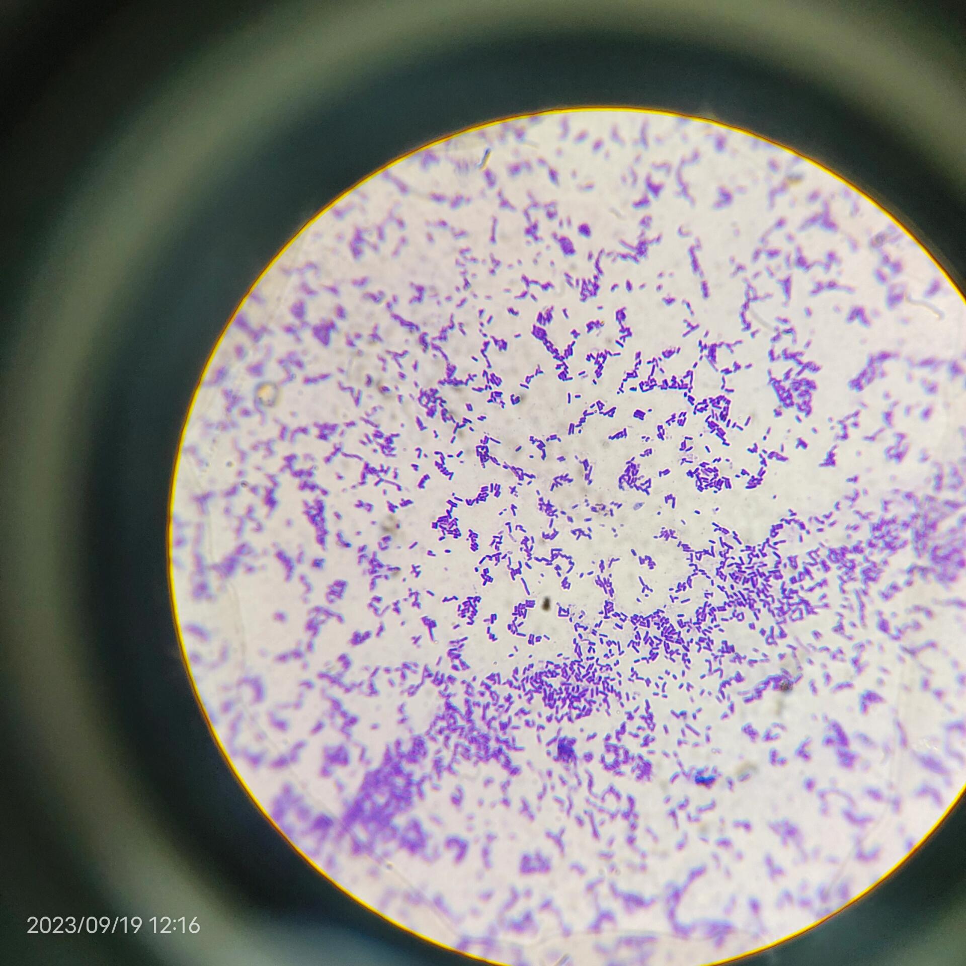 显微镜下的你们 大肠杆菌啊大肠杆菌