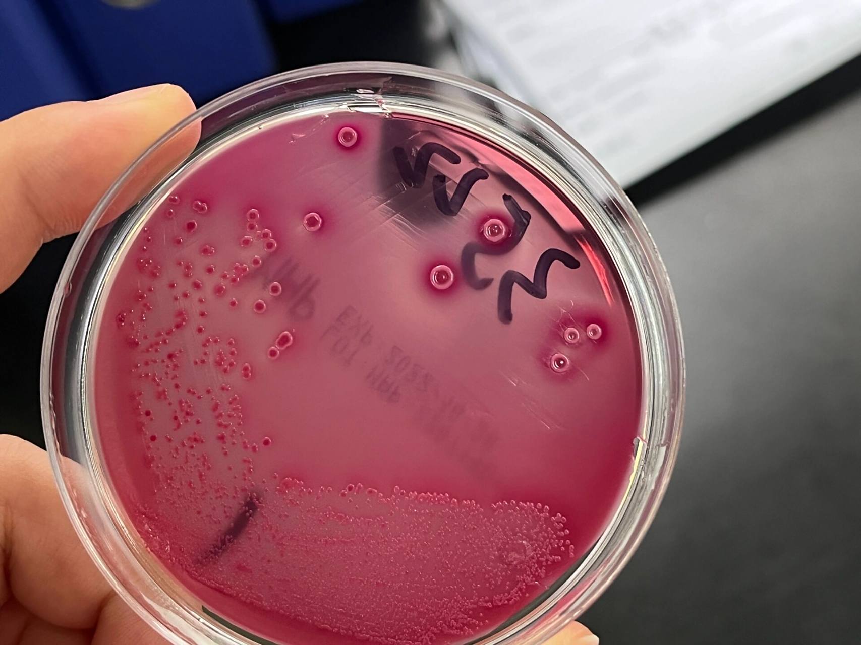 第一次见不分解乳糖的大肠埃希菌 p1 麦康凯平板无色,不分解乳糖为不