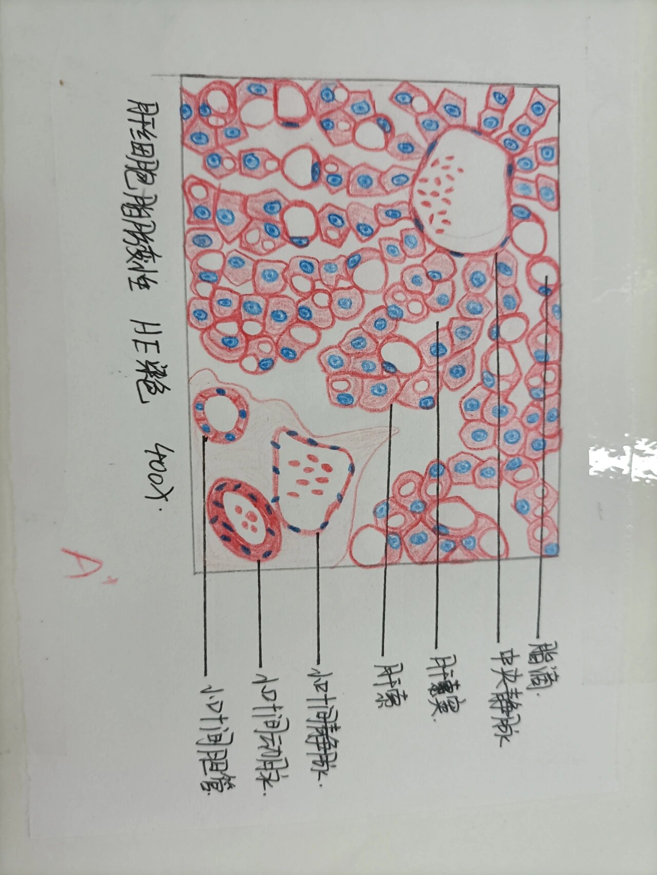 普通医学生病理切片绘图 (一) 1.干细胞脂肪变性 2.肉芽组织 3.