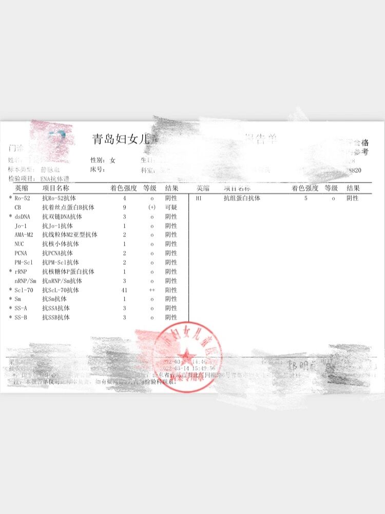 ena抗体谱 抗核抗体阳性 生殖科大夫说先不用药 打算去风湿免疫科去