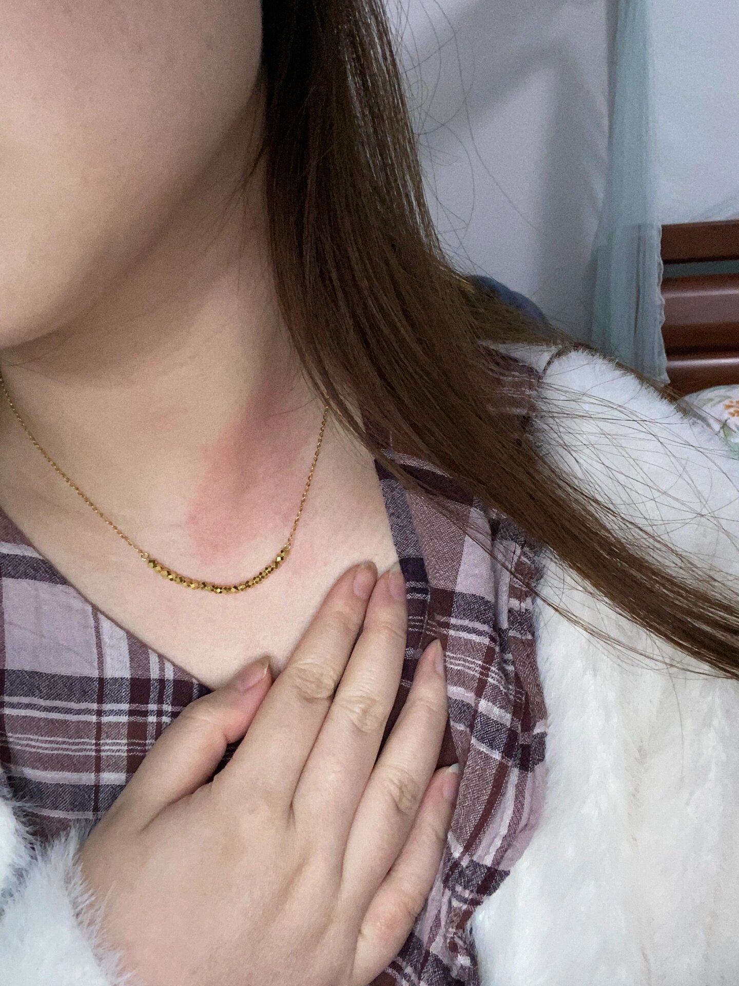 pdd和富隆旗舰店买的黄金项链过敏