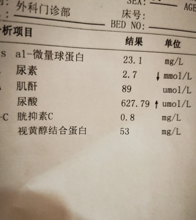 尿酸高的患者可以放心吃酵母做的馒头