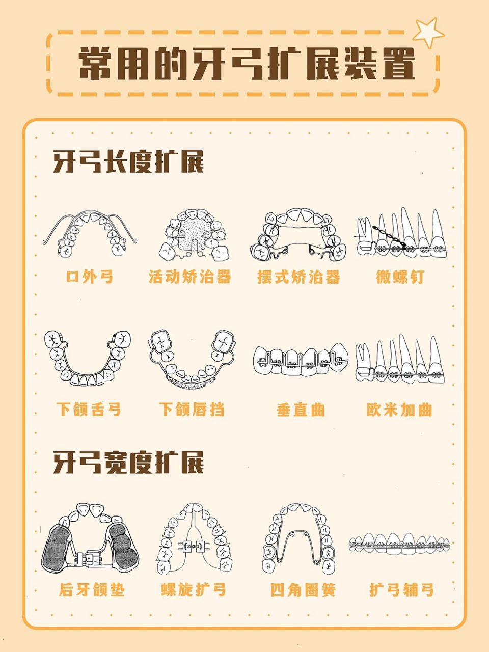 常用牙弓扩展装置 97牙弓长度扩展 73推磨牙向远中 口外弓:由内弓