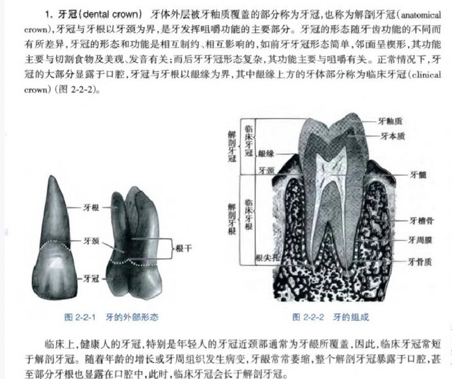 解剖牙冠→不暴露 临床牙冠→暴露→能看见的都是 (可同理分辨解剖
