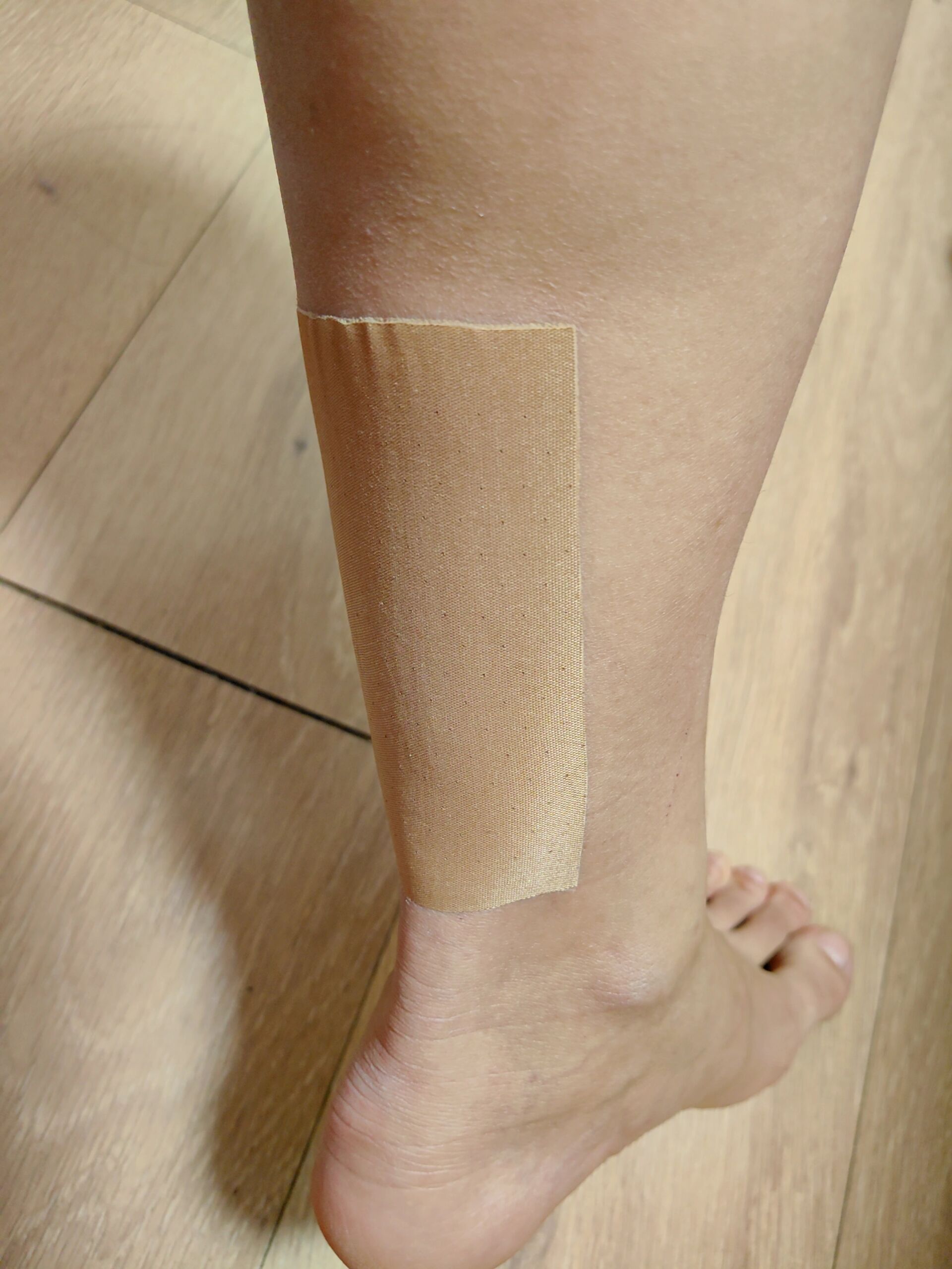 两条小腿肚后侧一直疼 如图,贴膏药这个位置一直疼,小腿下侧正后方