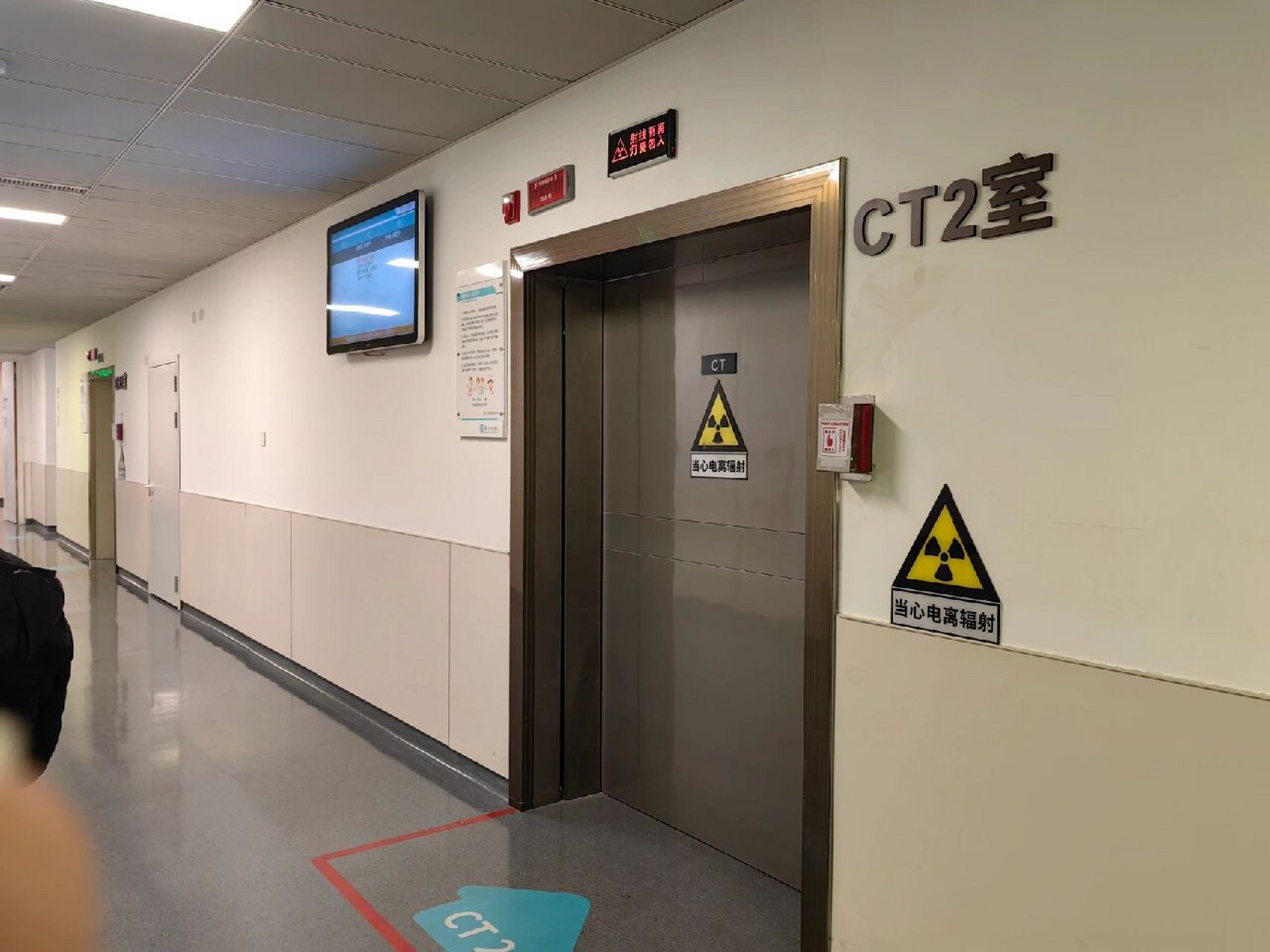 阳康后心电图 ct 心肌酶检查,400搞定 阳康后一周心脏开始感觉闷闷的