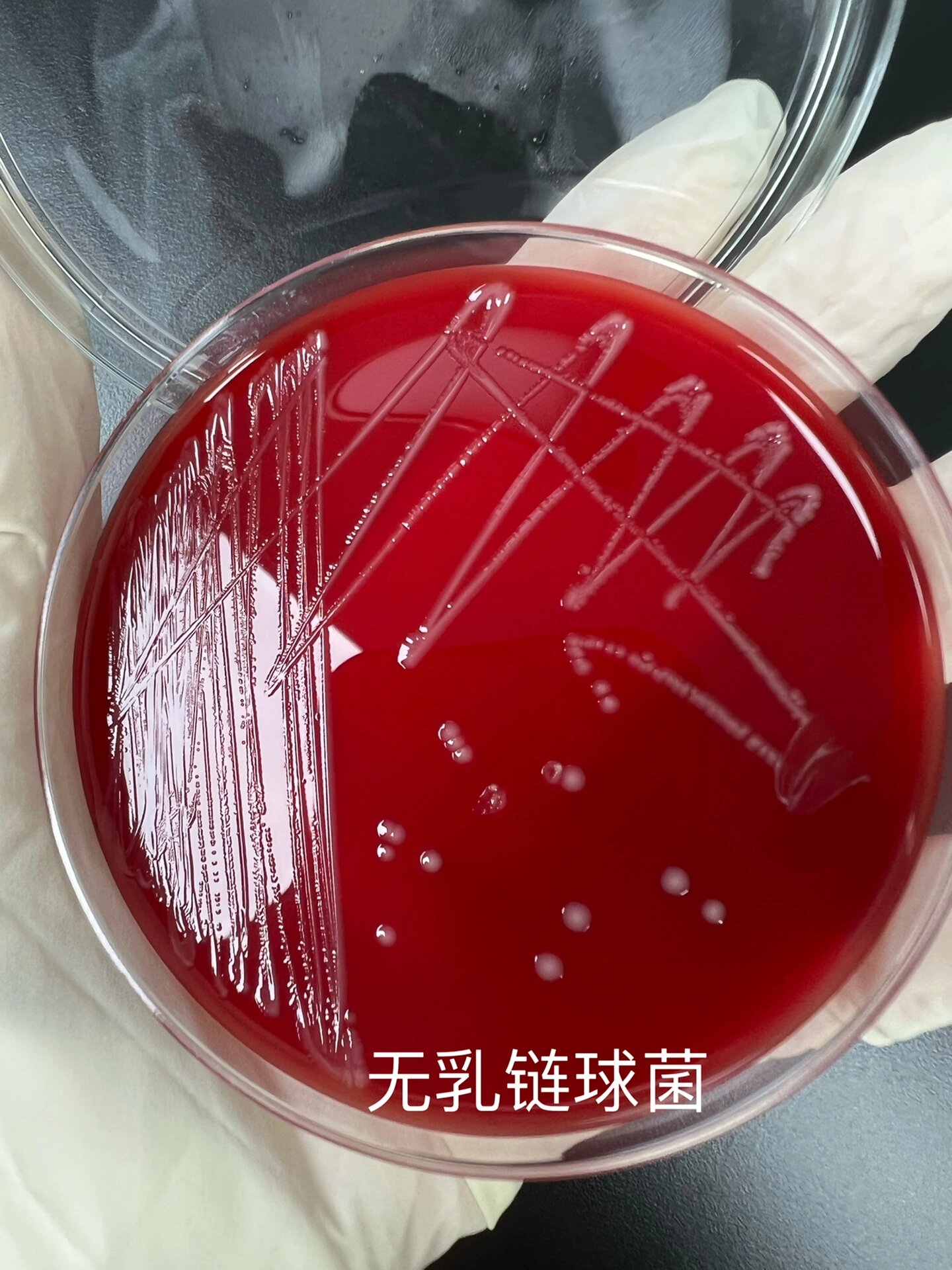 几种常见链球菌 最近培养出的几种链球菌.