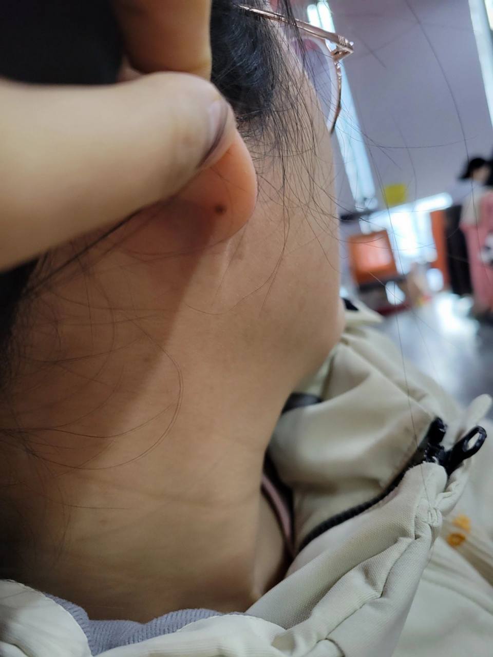 耳垂后面有个痣代表啥?