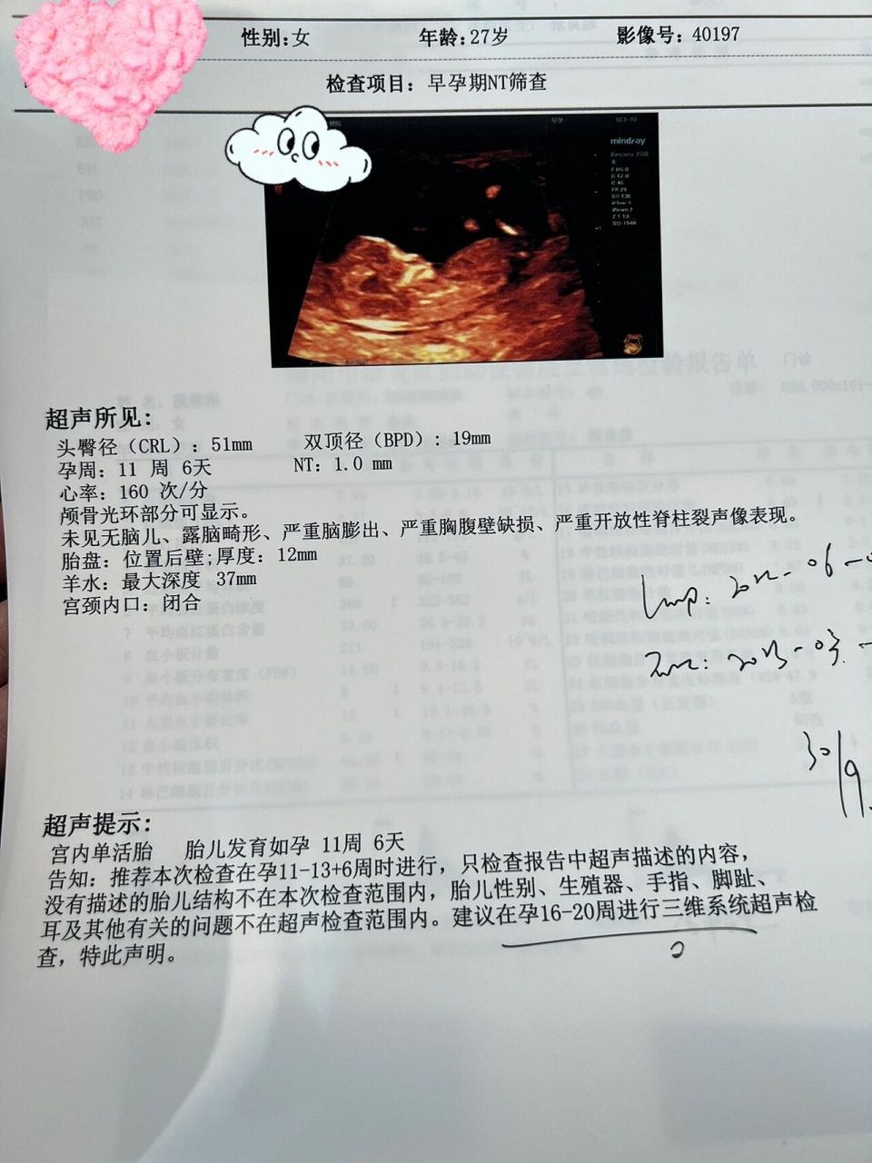 宝宝真的比想象中坚强得多 上个月还在出血吃药保胎