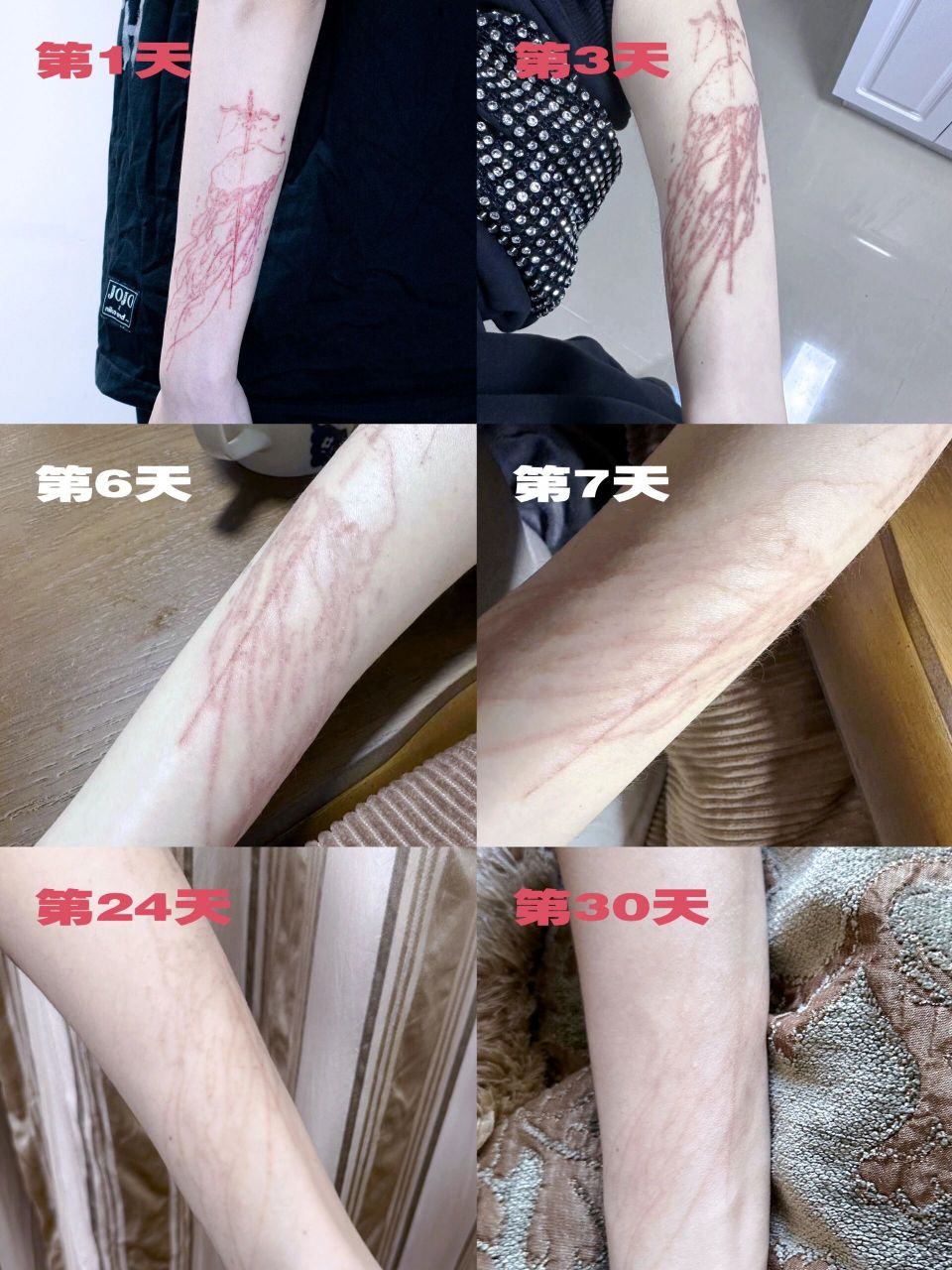 空针纹身恢复过程 非常适合空针纹身的元素水母08 来看看他在身体里