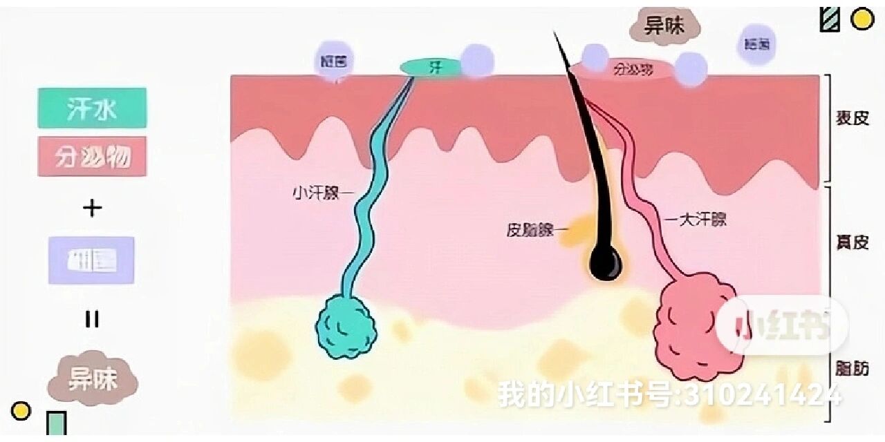 但,真的会"一劳永逸"吗71 	 因狐臭是腋下『大汗腺』分泌大量不