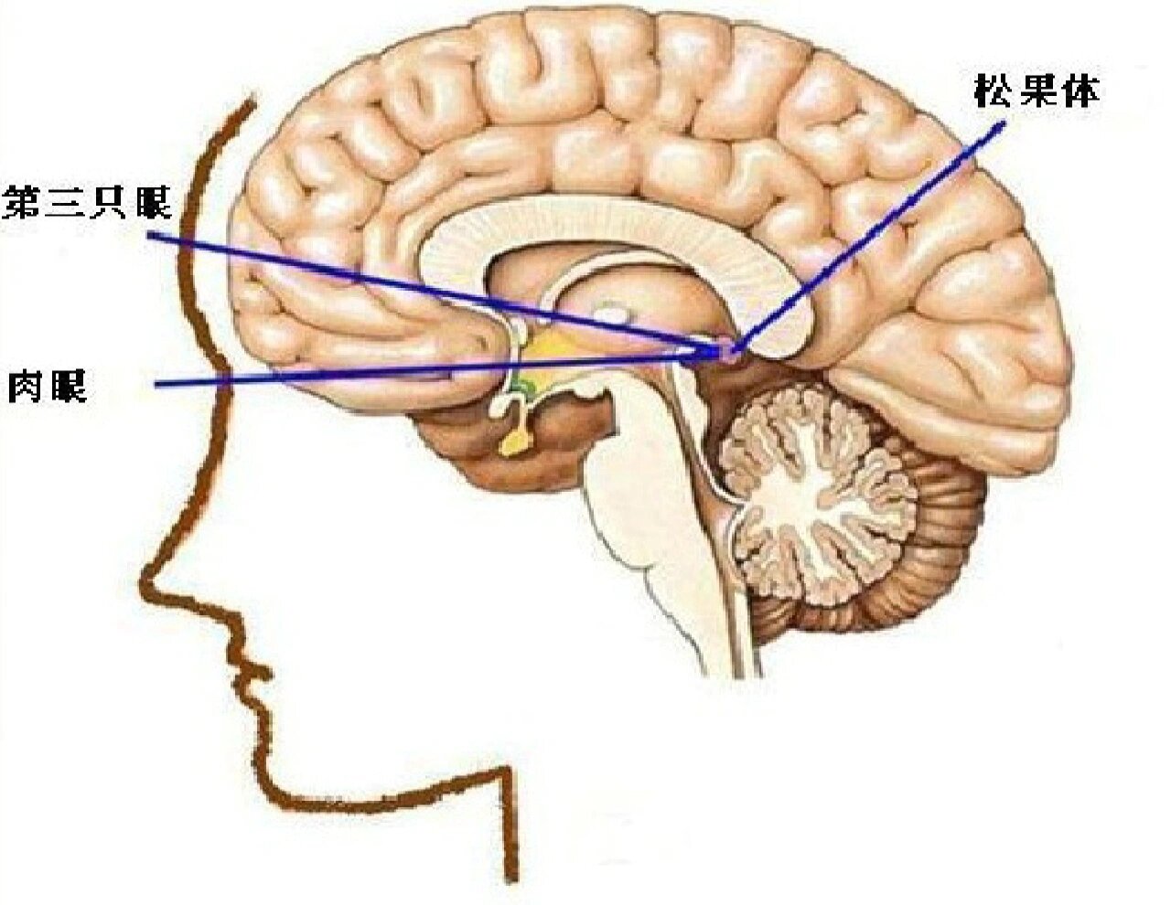 松果体横断图片